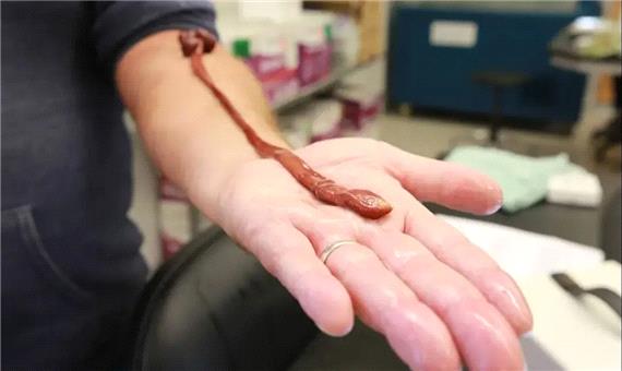 دانشمندان از سر کنجکاوی سن یک کرم آزمایشگاهی را اندازه گرفتند؛ نتیجه همه را غافلگیر کرد