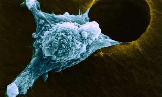 راهکار جلوگیری از بازگشت سرطان پس از درمان چیست؟