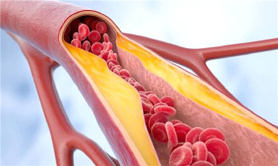 نوعی چربی در بدن که به تنظیم فشار خون کمک می‌کند