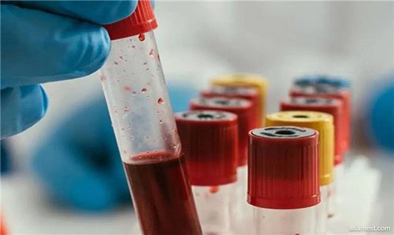 تولید آلبومین در پالایشگاه خون؛ صادرات کیت‌های تشخیصی به 3 کشور