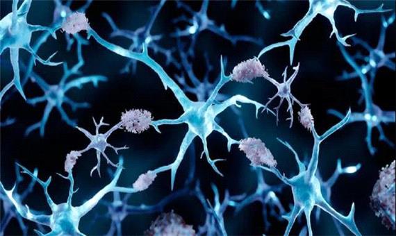 چرا مبتلایان به سرطان از آلزایمر مصون‌اند؟