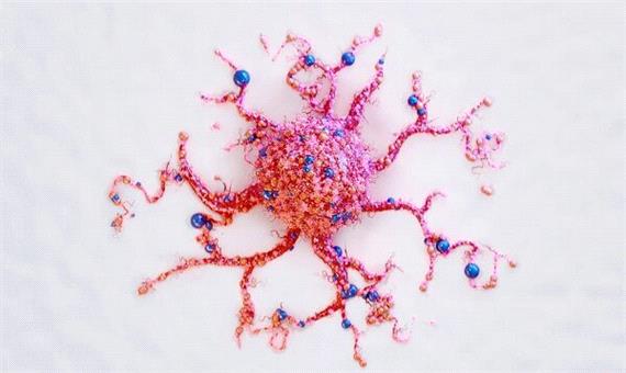 تشخیص سرطان در خانه فقط با تست ادرار!