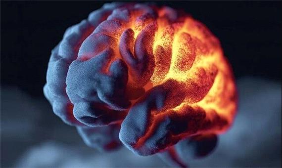 یک بیماری خاموش مغزی خطر زوال عقل را 4 برابر می‌کند