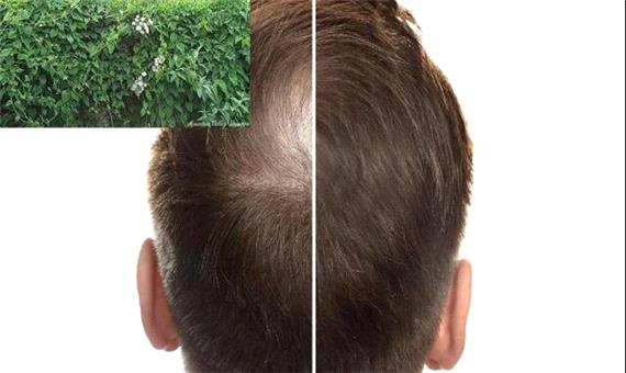 این گیاه می‌تواند کلید رشد مجدد مو باشد