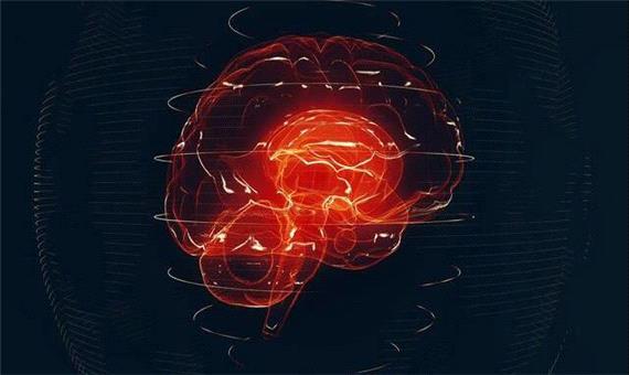 هوش مصنوعی دستیار جدید متخصصان مغز و اعصاب