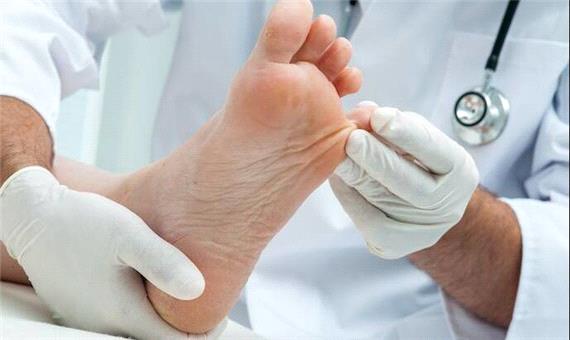 ژل نجات‌بخش؛ اکسیژن‌رسانی به زخم‌های التیام‌ناپذیر برای جلوگیری از قطع عضو