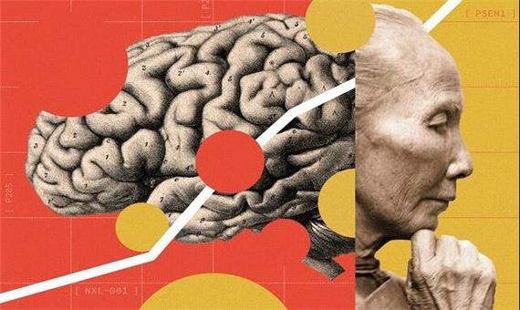 چین در خط مقدم نبرد با آلزایمر