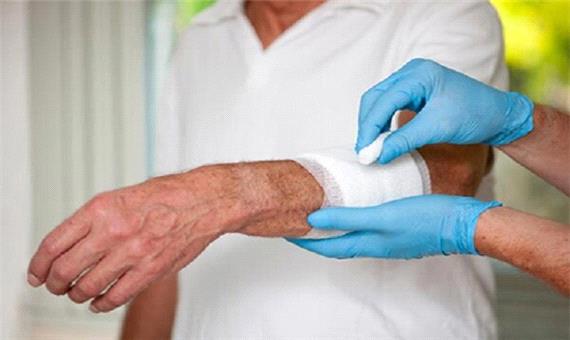 تولید پانسمان‌های هوشمند با ساختاری مشابه پوست طبیعی