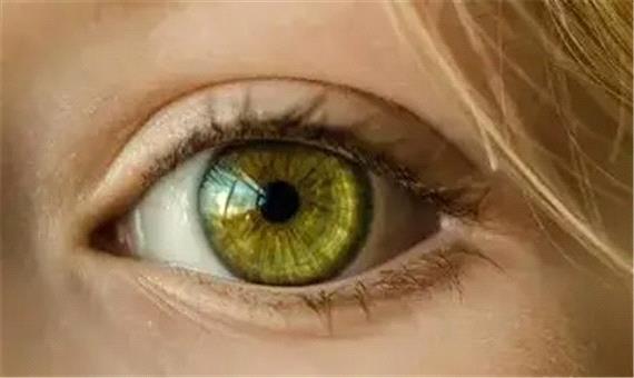 ویژگی نادری که فقط 2 درصد انسان‌ها دارند