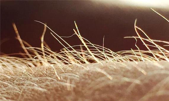 خارش احتمالا اندام حسی مخصوص به خود را دارد