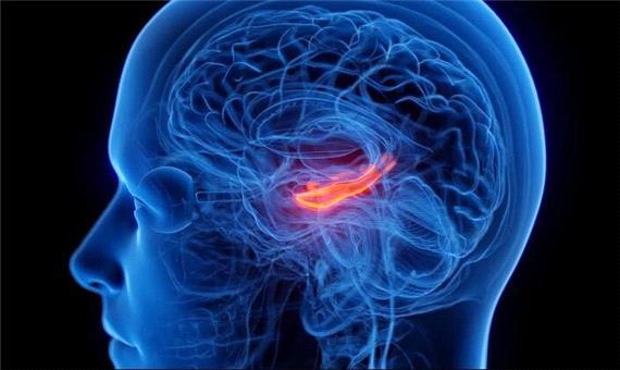 کوچک شدن مرکز حافظه مغز در افراد افسرده