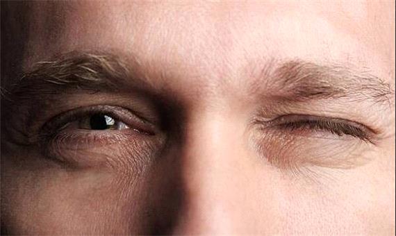 سلول بنیادی بینایی بیماران ژنتیکی را نجات می دهد