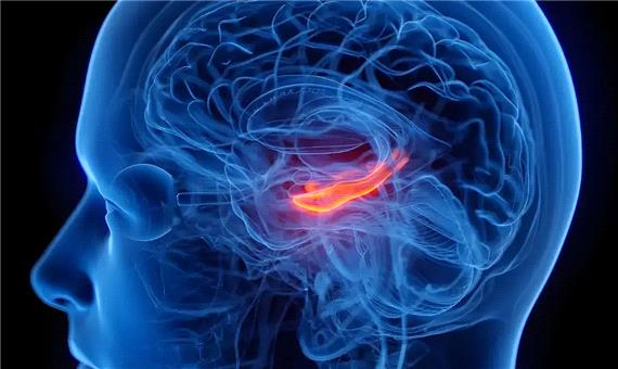 افسردگی با کوچک‌ترشدن بخشی از مرکز حافظه در مغز مرتبط است
