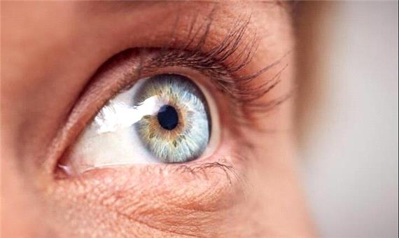 چشم‌ها می‌توانند خطر ابتلا به آلزایمر را آشکار کنند؟ | آخرین خبر