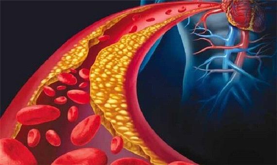 ژن درمانی کلسترول بد را 50 درصد کاهش داد