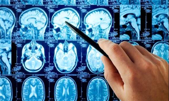 افزایش امنیت هوش مصنوعی در تحلیل MRI مغز با راه حل پژوهشگران دانشگاهی