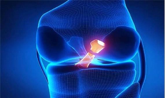 مقایسه دو روش ترمیم مینیسک زانو در پژوهش محققان ایرانی