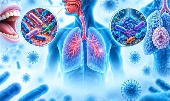 تفاوت عجیب میکروب‌های دهان و ریه مبتلایان به «کووید طولانی» نسبت به دیگران