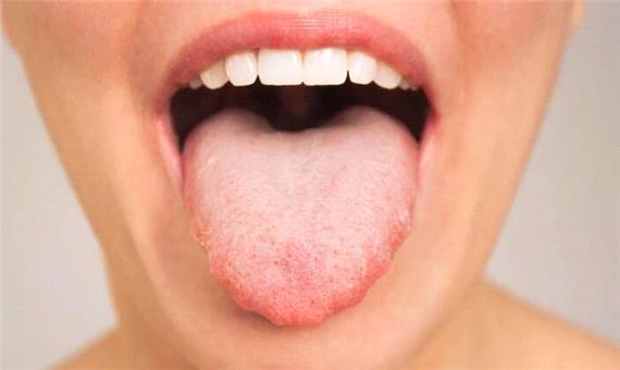 ارتباط عجیب باکتری‌های دهان با سرعت تفکر ما