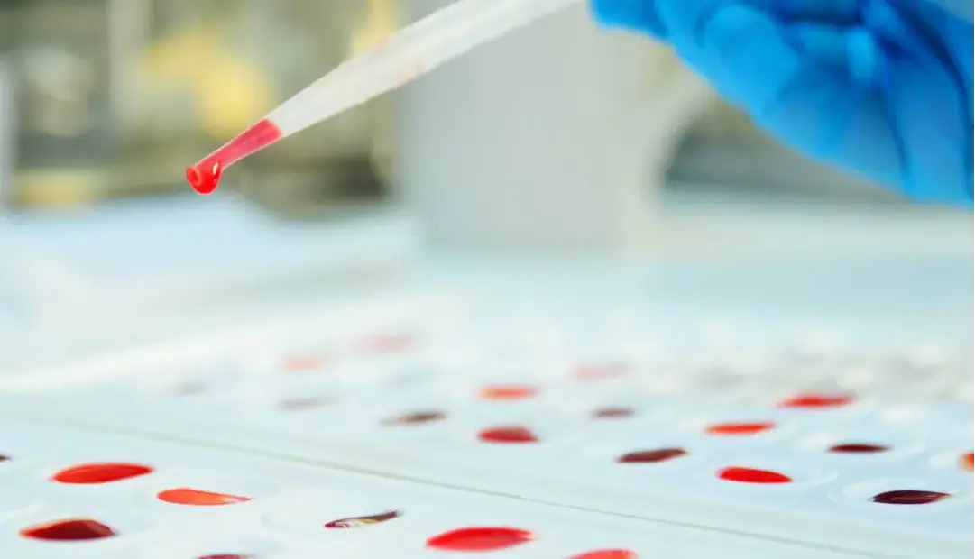 خون طلایی؛ فقط 50 نفر صاحب نادرترین گروه خونی دنیا هستند